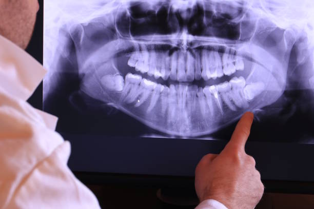Best Emergency Dental Care for Abscessed Tooth in Forest Hill, TX