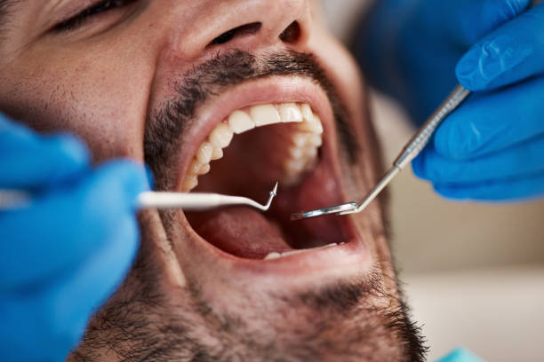 Best Emergency Dental Care for Abscessed Tooth in Forest Hill, TX